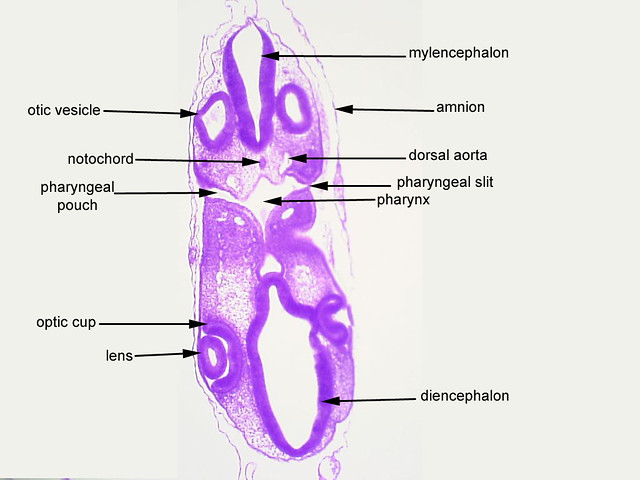 Serial