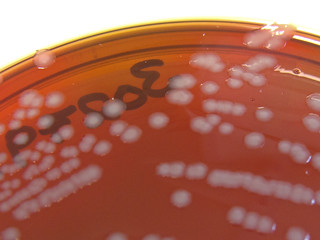 Neisseria gonorrhoeae on New York City Agar (LCAT) - Detail