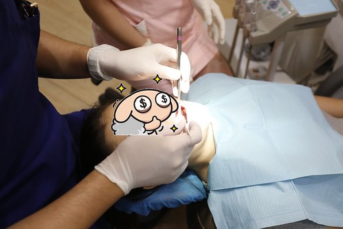 我的蛀牙得救了！板橋絕美牙醫顏成翰醫師的顯微根管治療術拯救了我 (5)