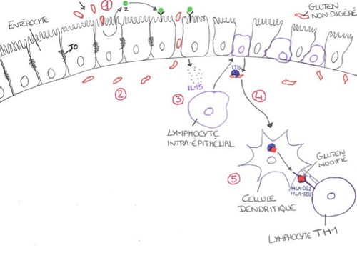 mécanismes moléculaires de la maladie coeliaque