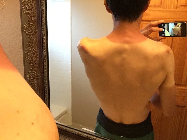 Unexpected/Unwanted tan in the neck